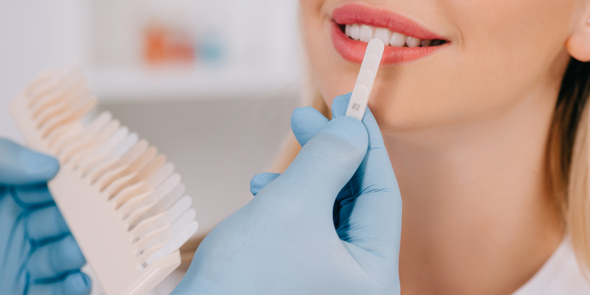 Preparing Teeth Whitening