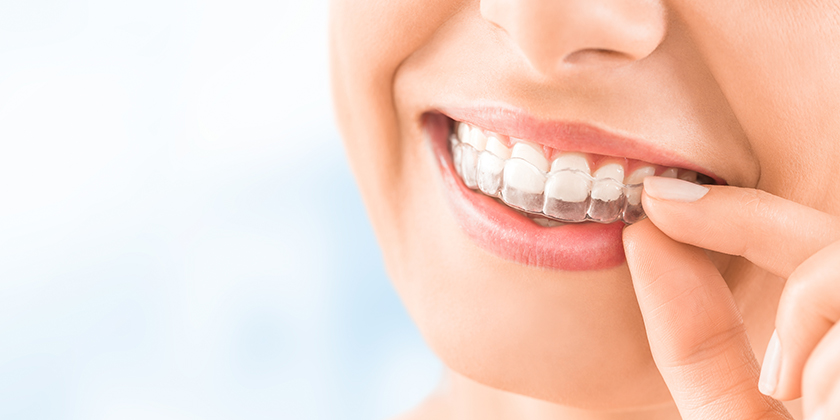 stains on your Invisalign