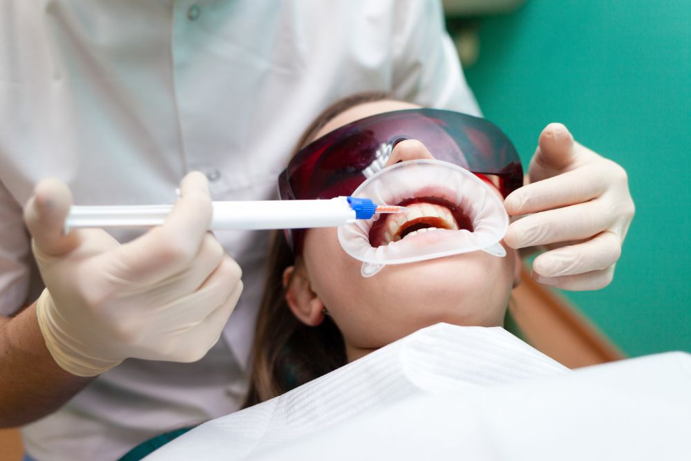 Professional Vs. Natural Teeth Whitening: Which Works Best?