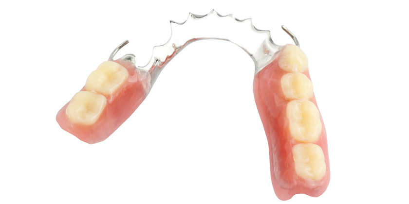 Setting Expectations For Partial Dentures