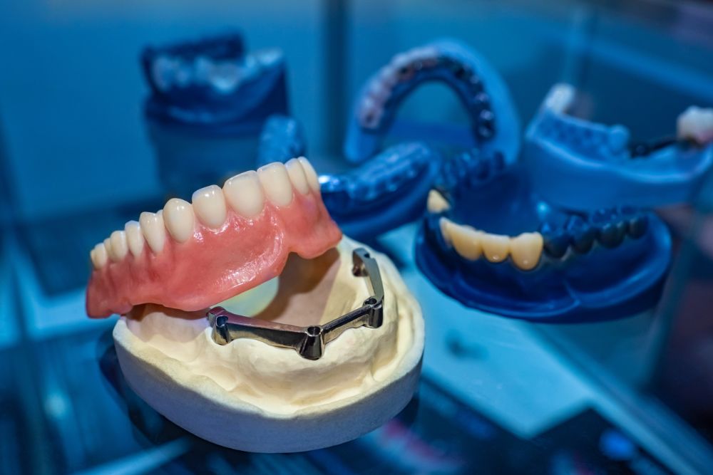 Should You Save Your Teeth With An Extraction Or Dental Crown?
