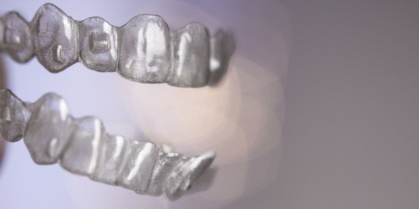 Should Retainers Be Worn For Life?