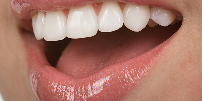 Smile Makeover Procedures Vs. Full-Mouth Reconstruction