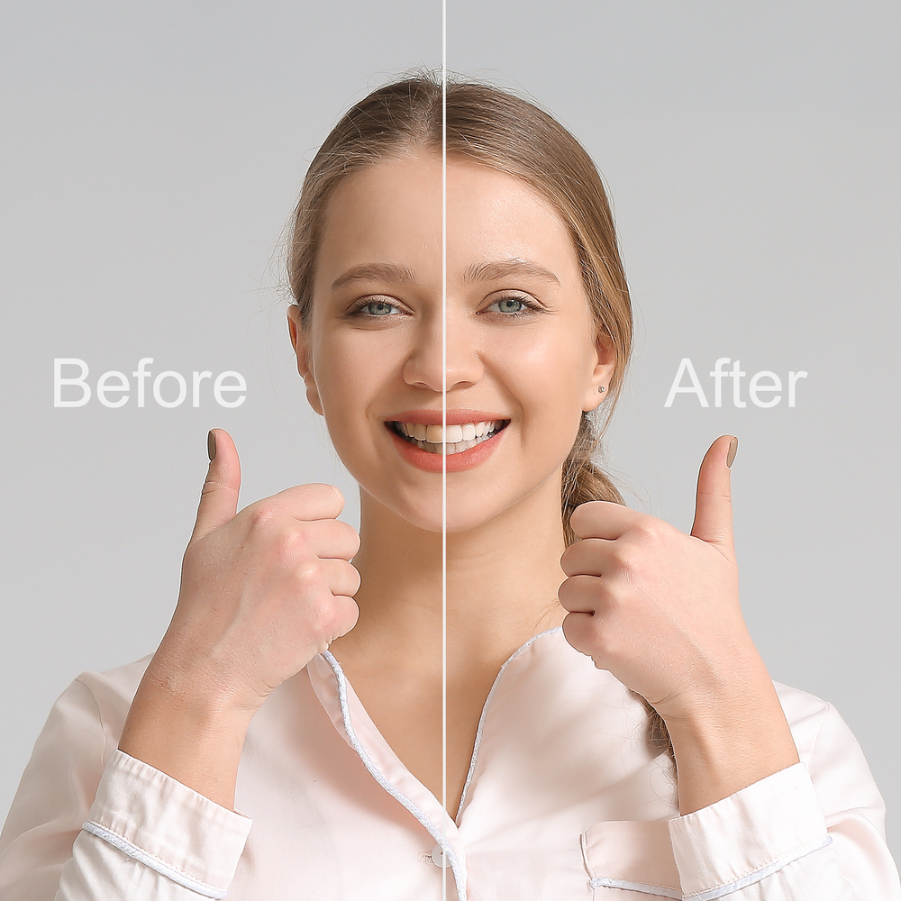 Smile Makeover Process: How Long Does It Take?