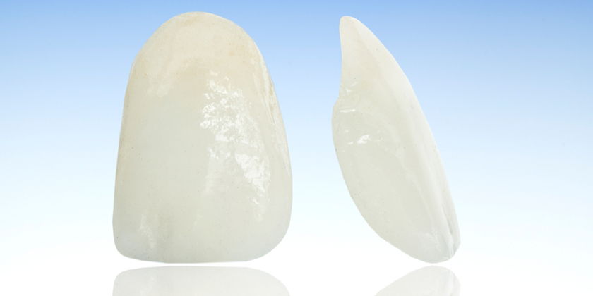 Tackling Dental Appearance Problems With Porcelain Veneers