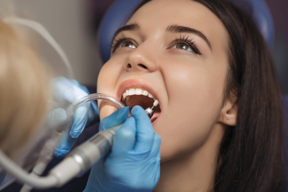 Teeth Cleaning Vs. Whitening: Understanding The Difference