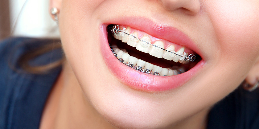 The A-Z of Interceptive Orthodontics