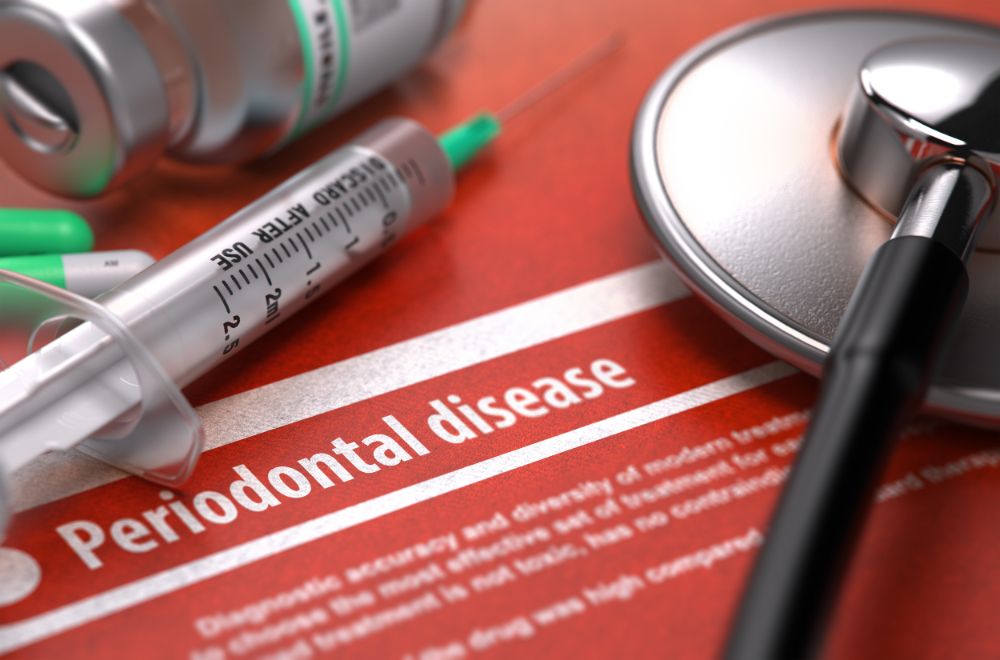 Things You Need To Know About Periodontal Disease