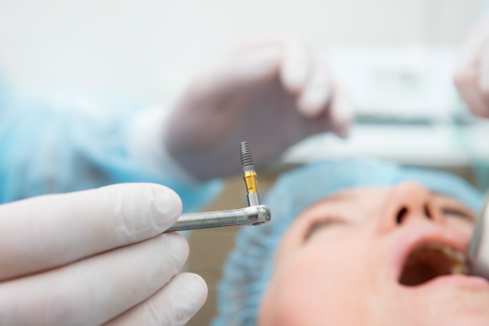 Dental Implant Surgery Anxiety