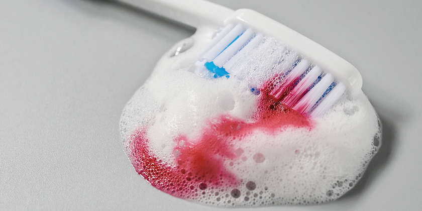 Understanding Gum Disease Risk Factors