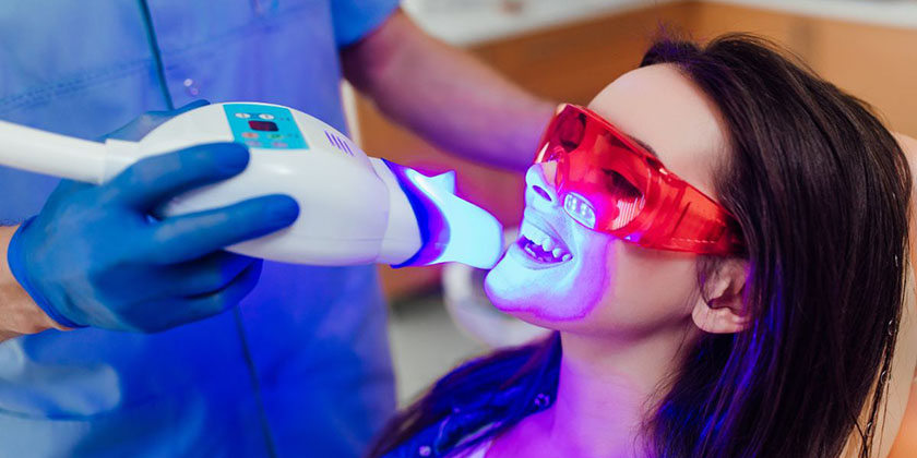 Understanding How Long Teeth Whitening WIll Last