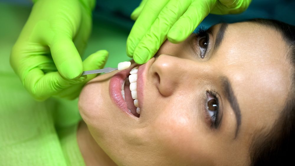 Porcelain Veneers