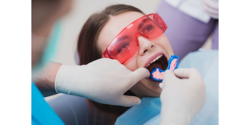 Understanding The Benefits Of Fluoride Treatment