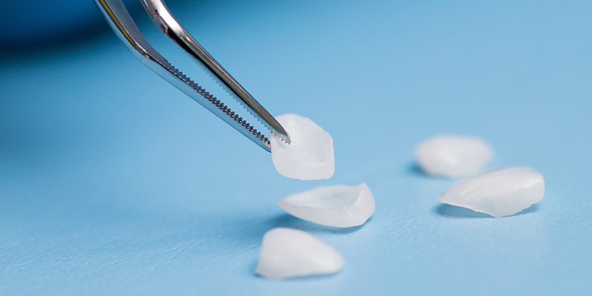 Veneer Maintenance Habits That You Should Consider