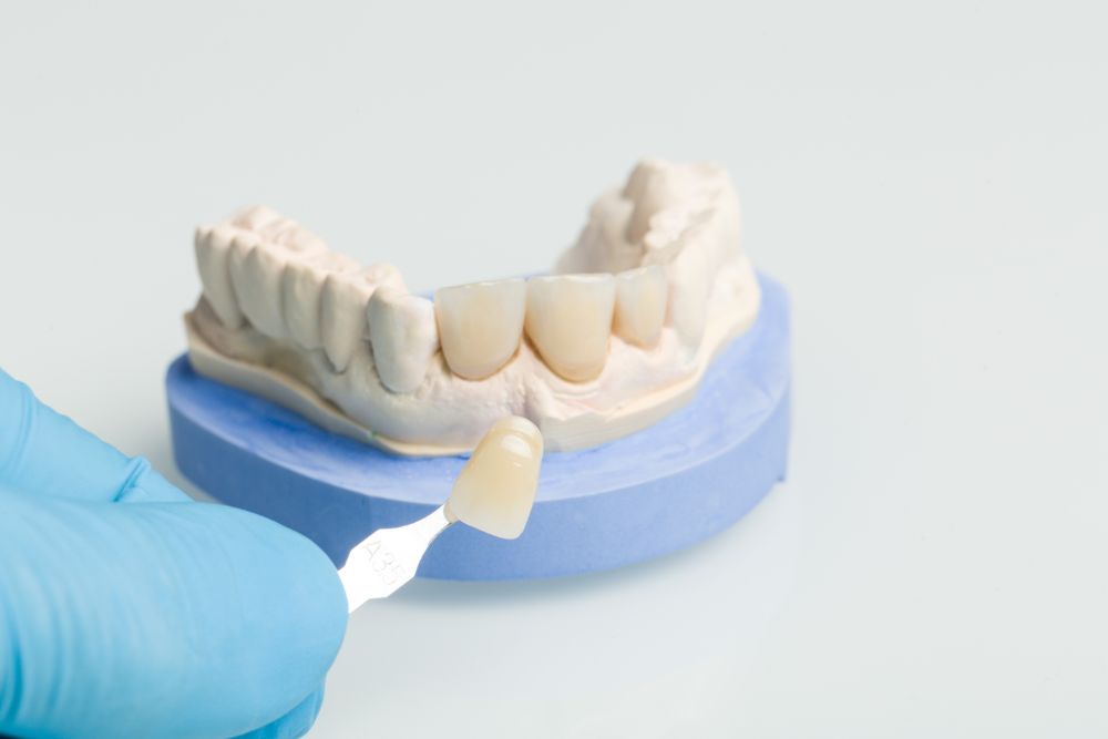 Veneers Vs. Dentures: Which To Choose?