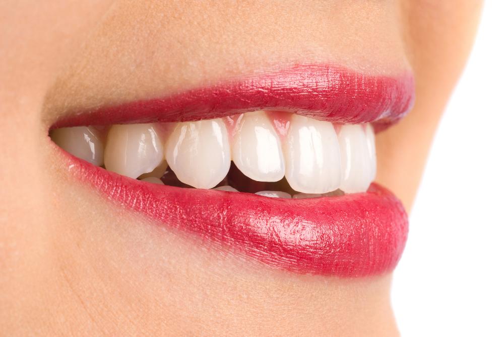 What Age Is Best To Get A Smile Makeover?
