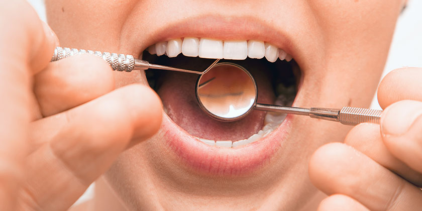 What Are The Different Stages Of Periodontal Disease?
