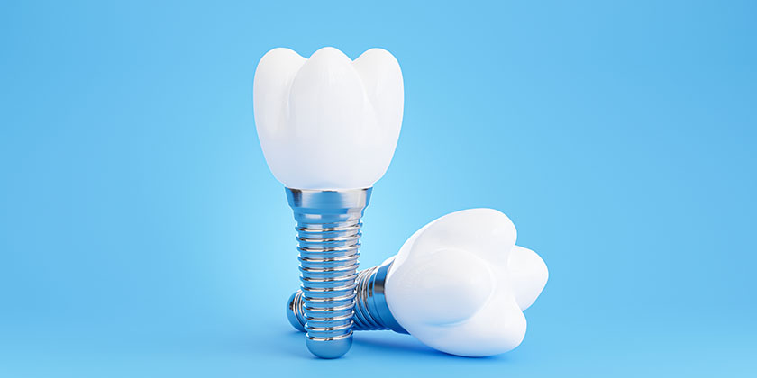 What Are The Different Types Of Dental Implants?