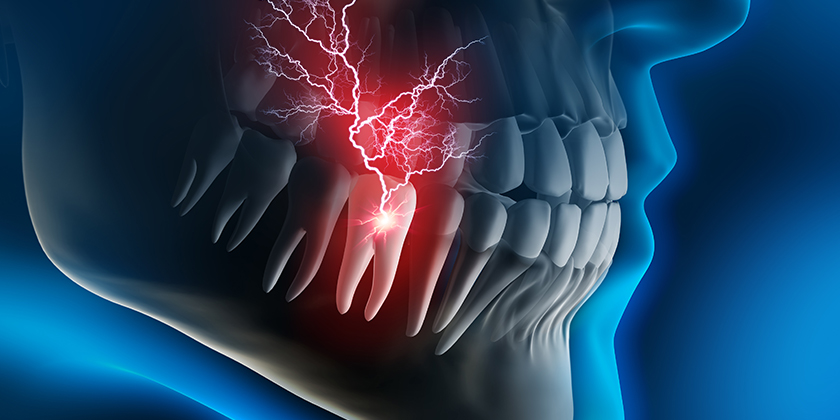 What To Do In The Event Of A Dental Emergency