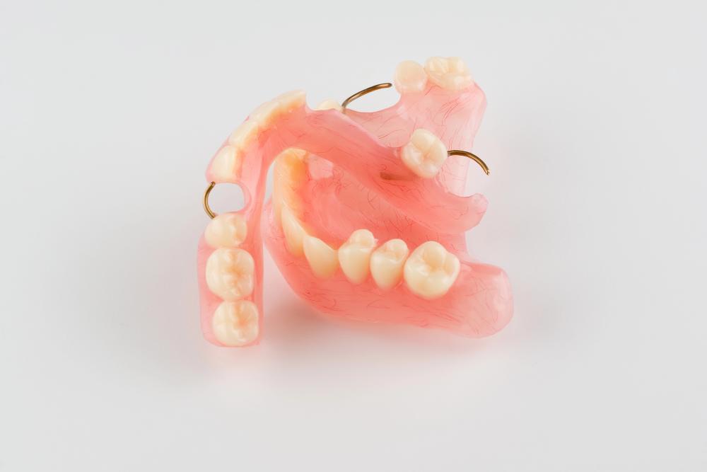 What to Expect When Getting Dentures for the First Time