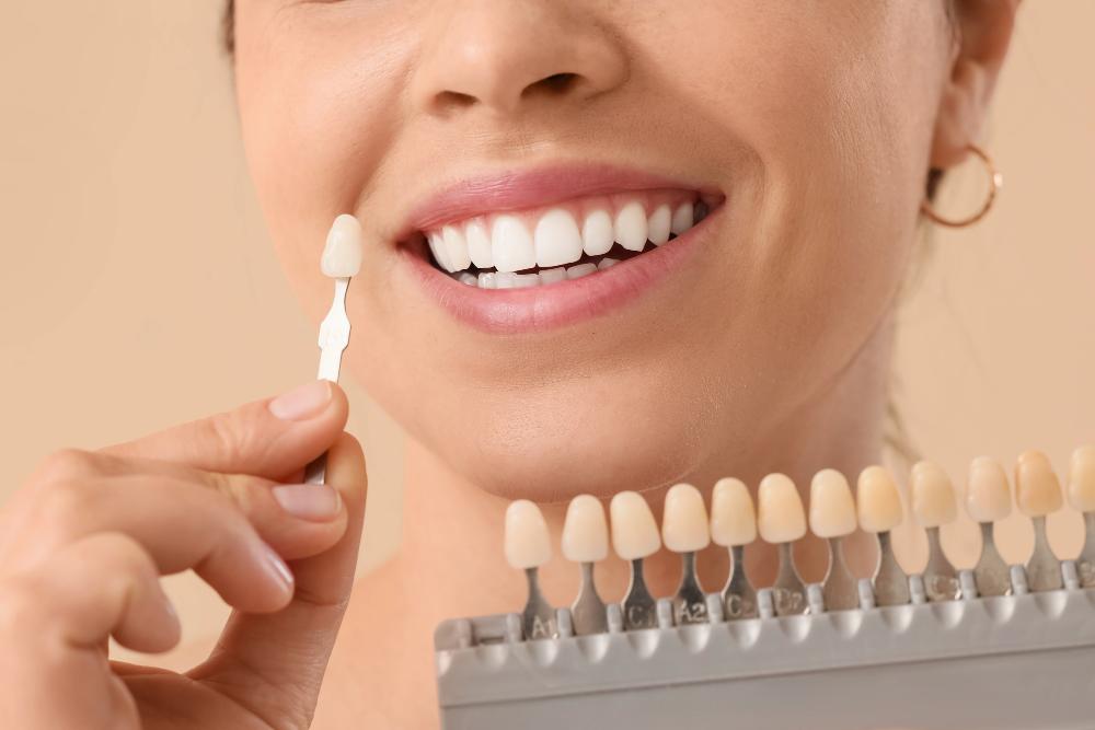 dentist that does veneers