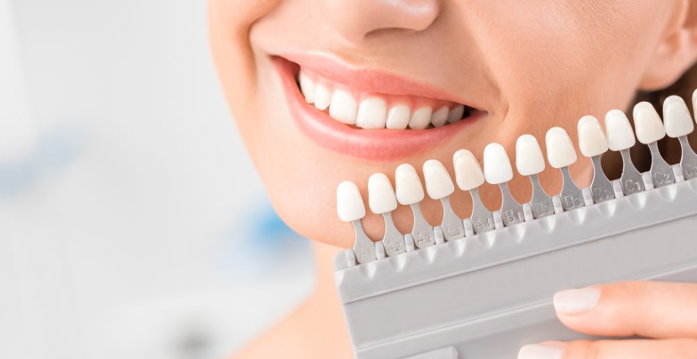What You Need To Know About Multiple Tooth Implants