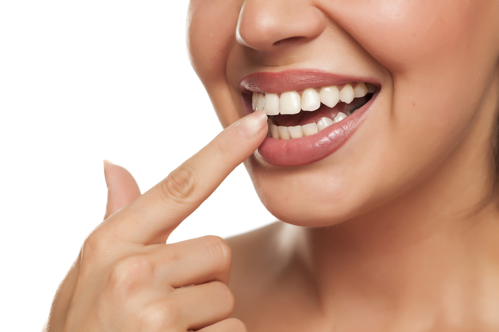 Hollywood Smile