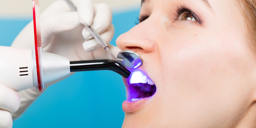 When Do Dentists Recommend Dental Bonding?
