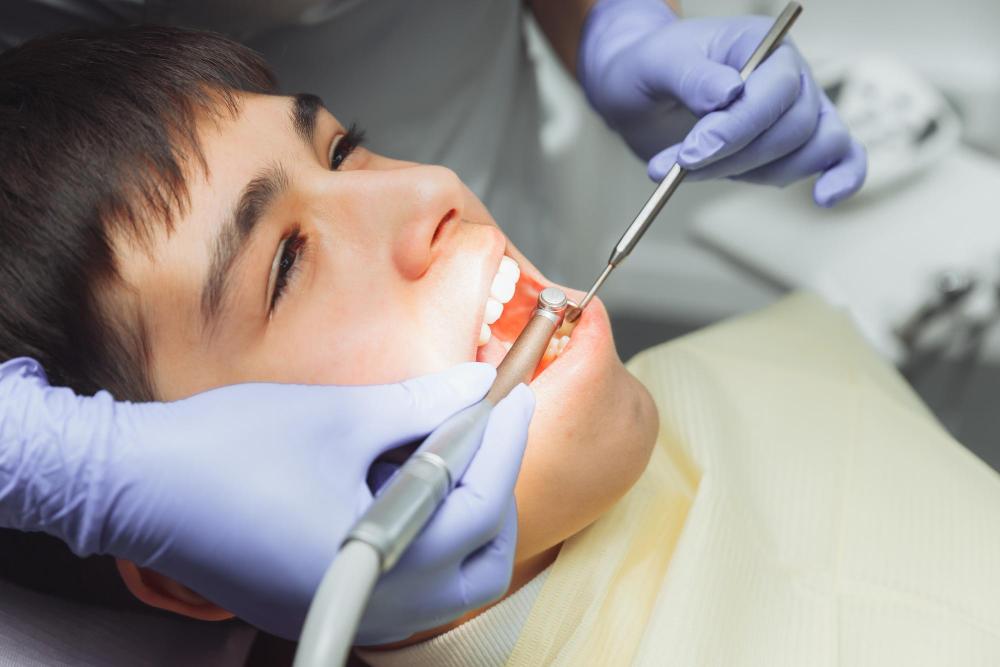 When Is It Safe To Brush Your Teeth After Wisdom Teeth Removal?