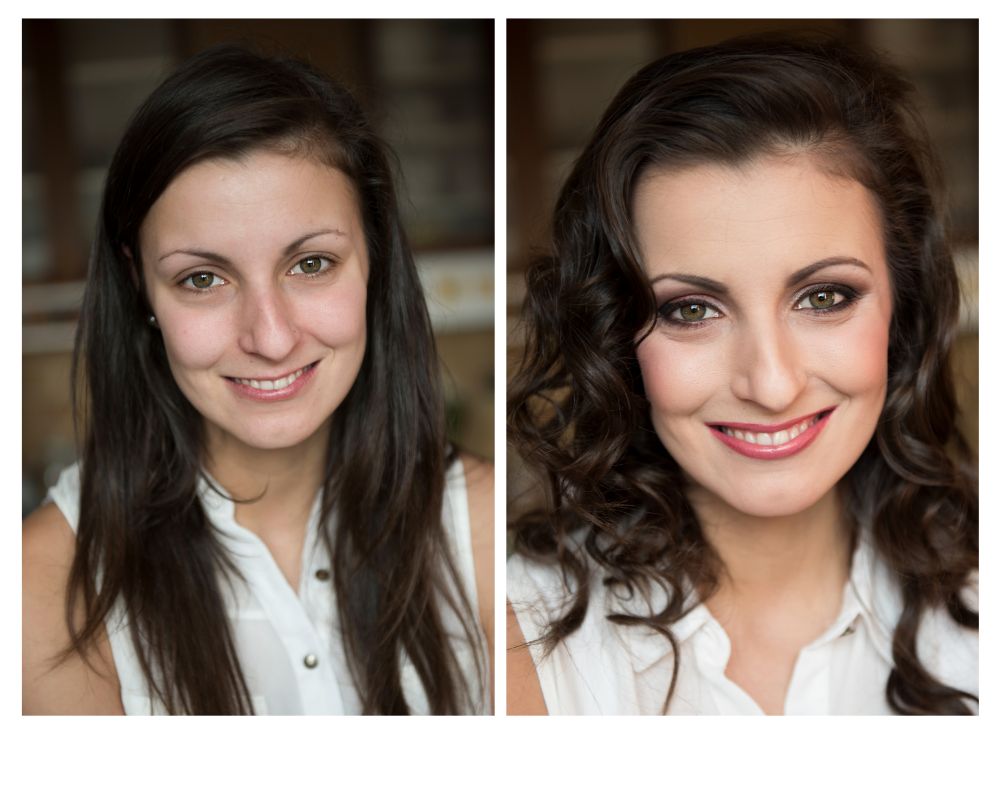 Where To Find The Best Smile Makeover In New York City
