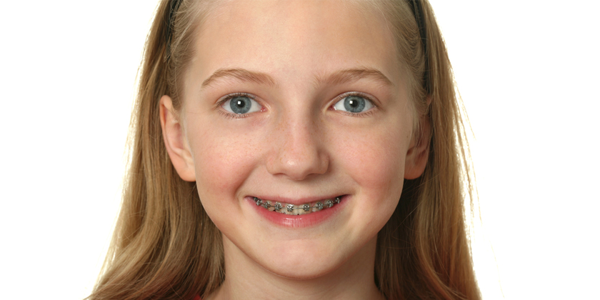 Why Children Should Get Dental Braces