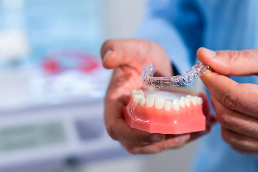 Why Do Invisalign Attachments Get Stained?