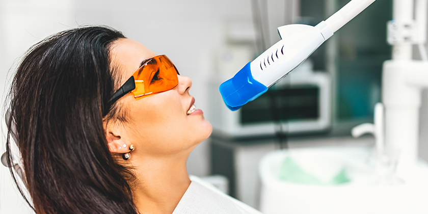 Why You Should Choose Professional Teeth Whitening