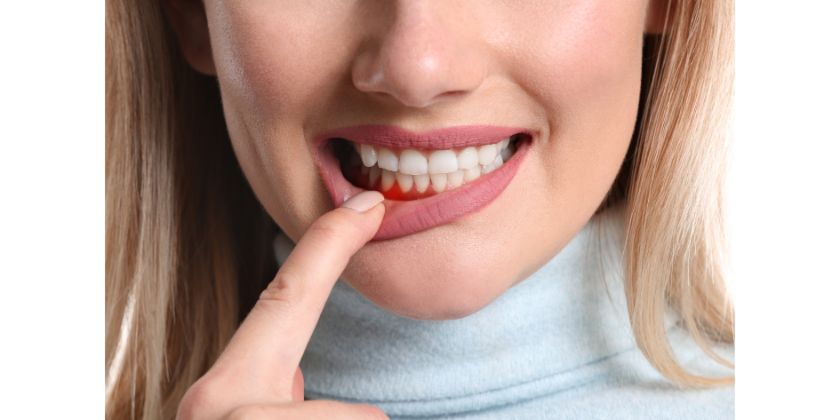 Your Gum Health Could Impact Your Stomach