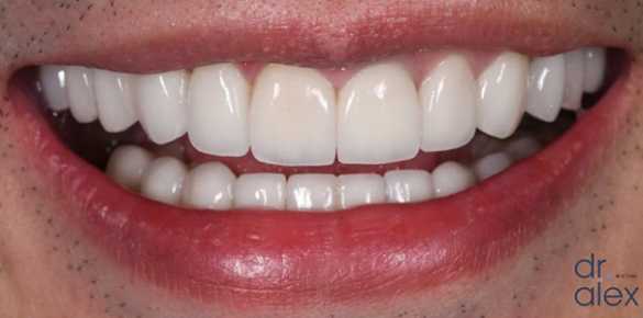 After Image