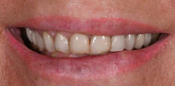 Before Image