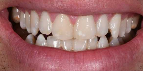 Before Image