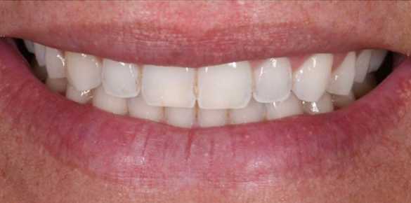 Before Image