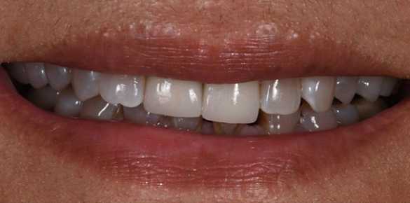 Before Image