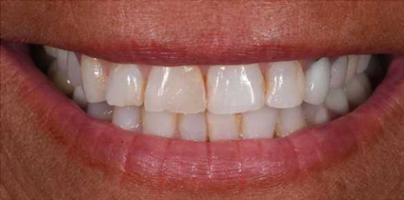 Before Image