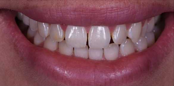 Before Image