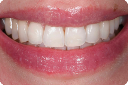 Ortal Asiss Image After