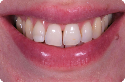 Ortal Asiss Image Before