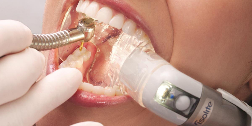 Why Every Dentist Should Be Using Isolite
