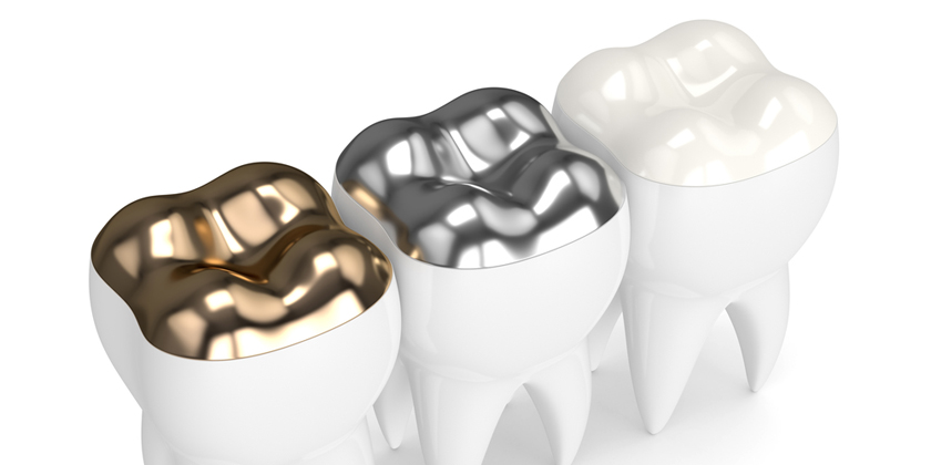 How Can Mercury Silver Fillings Be Safely Removed?