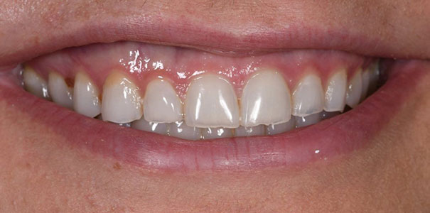 Before Image