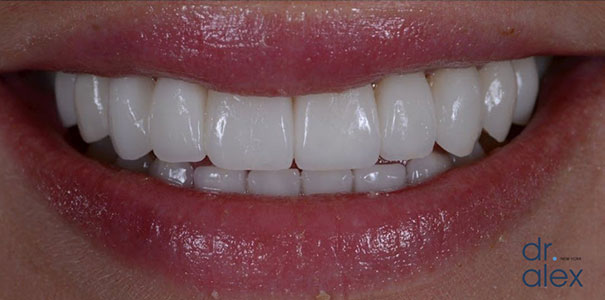 After Image