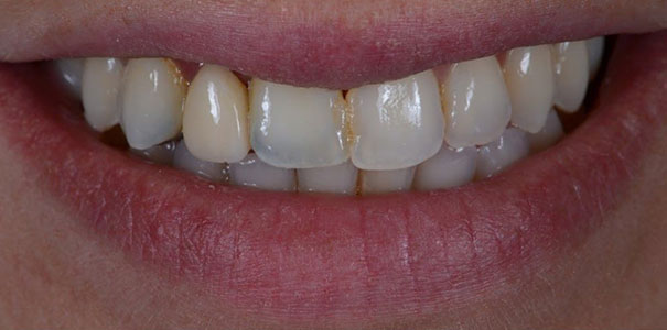 Before Image