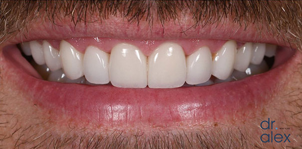 After Image