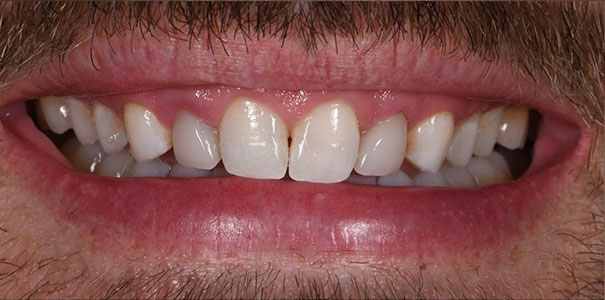 Before Image